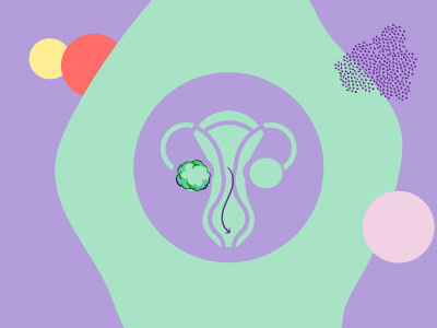 چگونه تنبلی تخمدان بر شانس بارداری اثر می گذارد؟